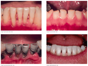 Dentistry 101